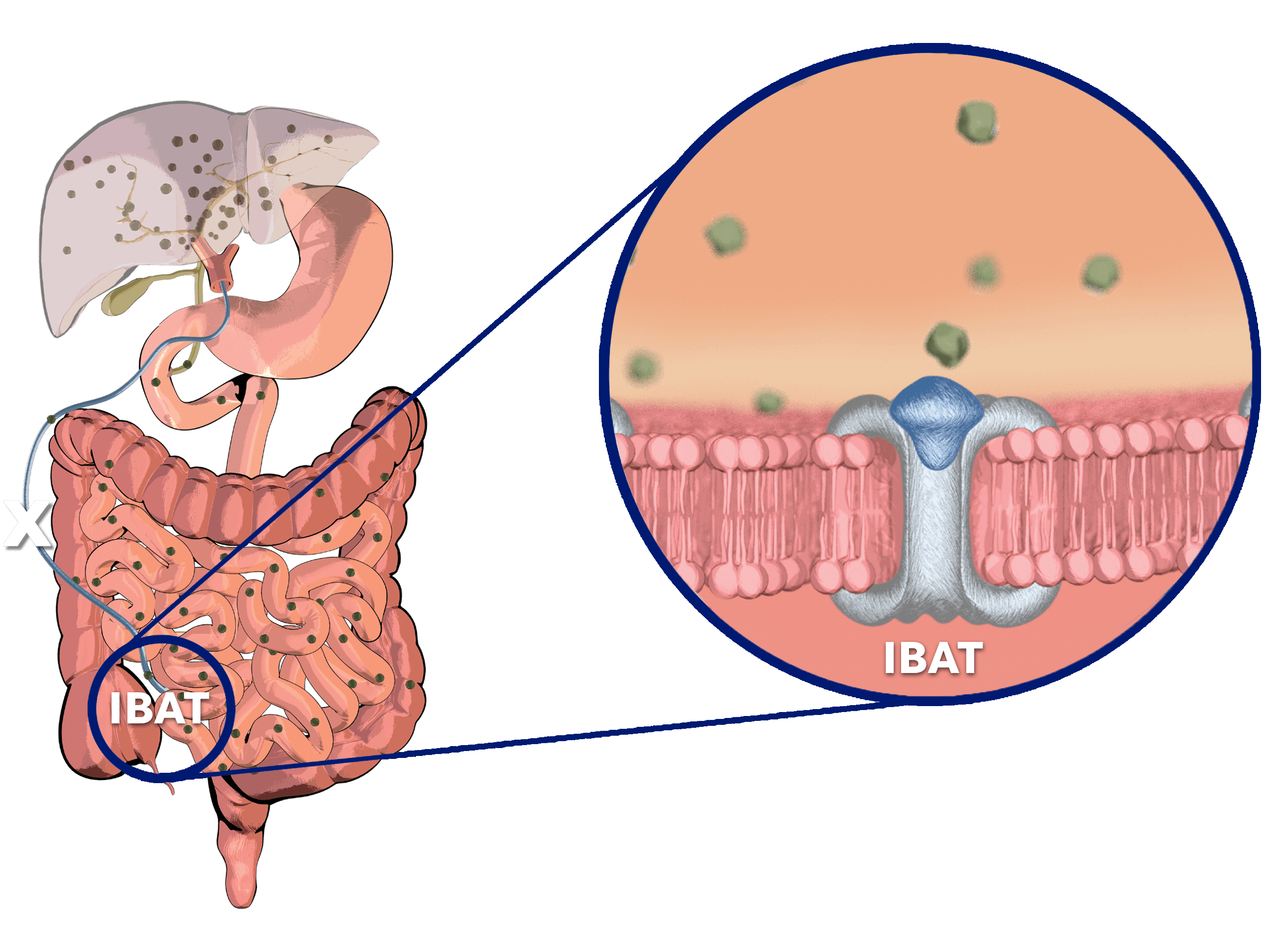 IBAT inhibitor